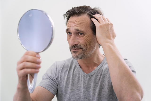A man in front of mirror seeing he looses hair